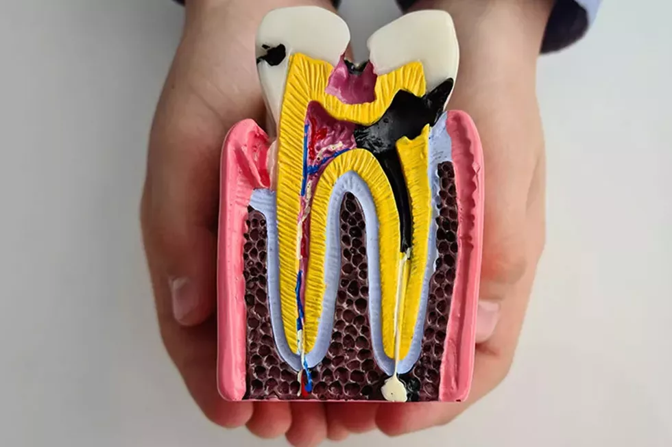 Endodontie Wurzelbehandlung